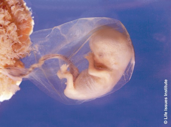 Завкафедрой эмбриологии МГУ: Эмбрион не может заявить свои права, это можем сделать мы