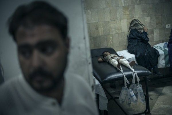 Мальчик, раненный во время столкновений, лежит в госпитале