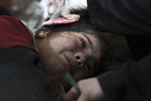 © Badra Mame/Reuters Раненый ребенок в полевом госпитале в Аль-Гута, пригороде Дамаска.