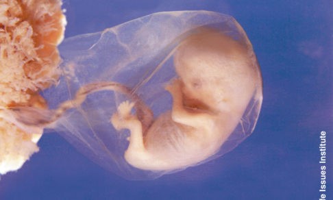 Завкафедрой эмбриологии МГУ: Эмбрион не может заявить свои права, это можем сделать мы