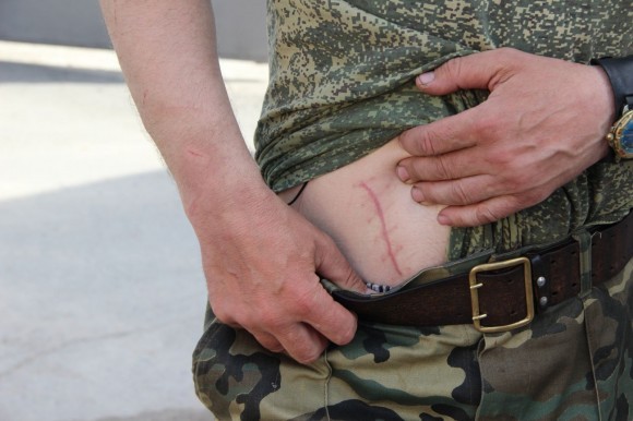 Аппендикс отцу Николаю вырезали за месяц до нападения