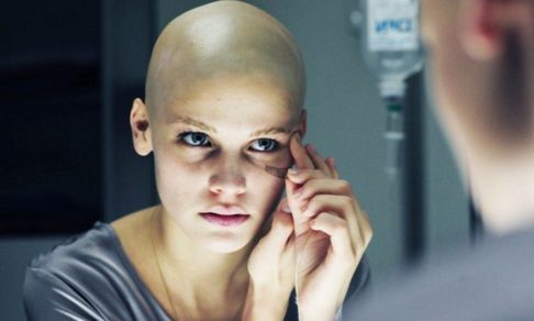 Как пережить химиотерапию (видео)
