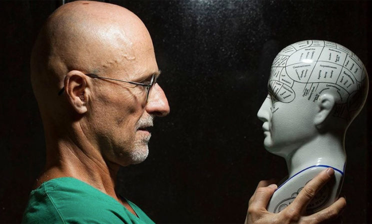 Пересадка головы – что это было на самом деле