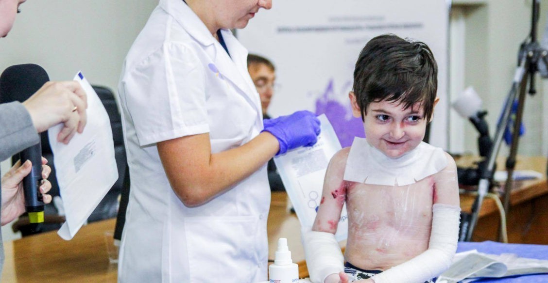 Дети-бабочки – когда ты чувствуешь боль всей кожей