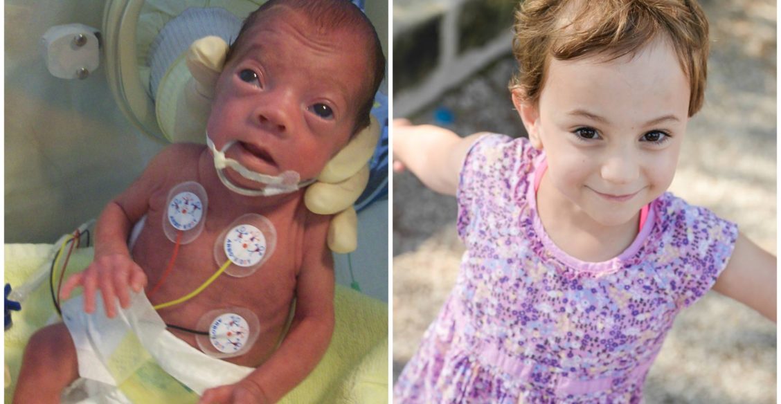 Как устроена система помощи недоношенным в Германии