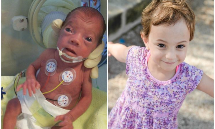 Как устроена система помощи недоношенным в Германии