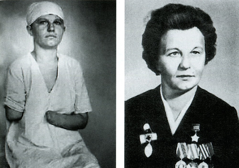 Зина Туснолобова
