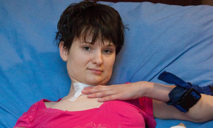Недавно Аня вырвала трахеостому и стала дышать сама