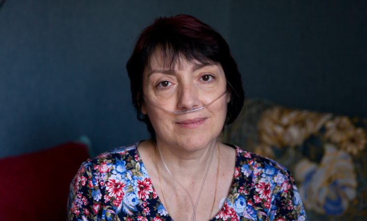 «Жду пересадки легких, чтобы играть с внуками в мяч»