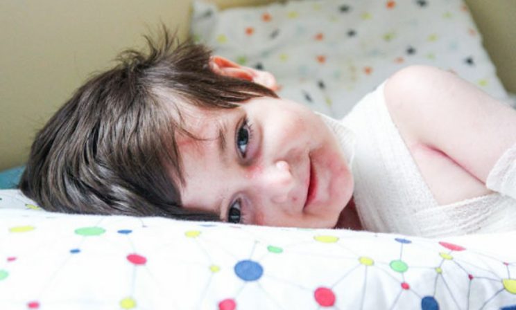 Раньше врачи их хоронили, а сегодня они идут в школу. Но почему люди с редкими болезнями остаются «бесхозными»