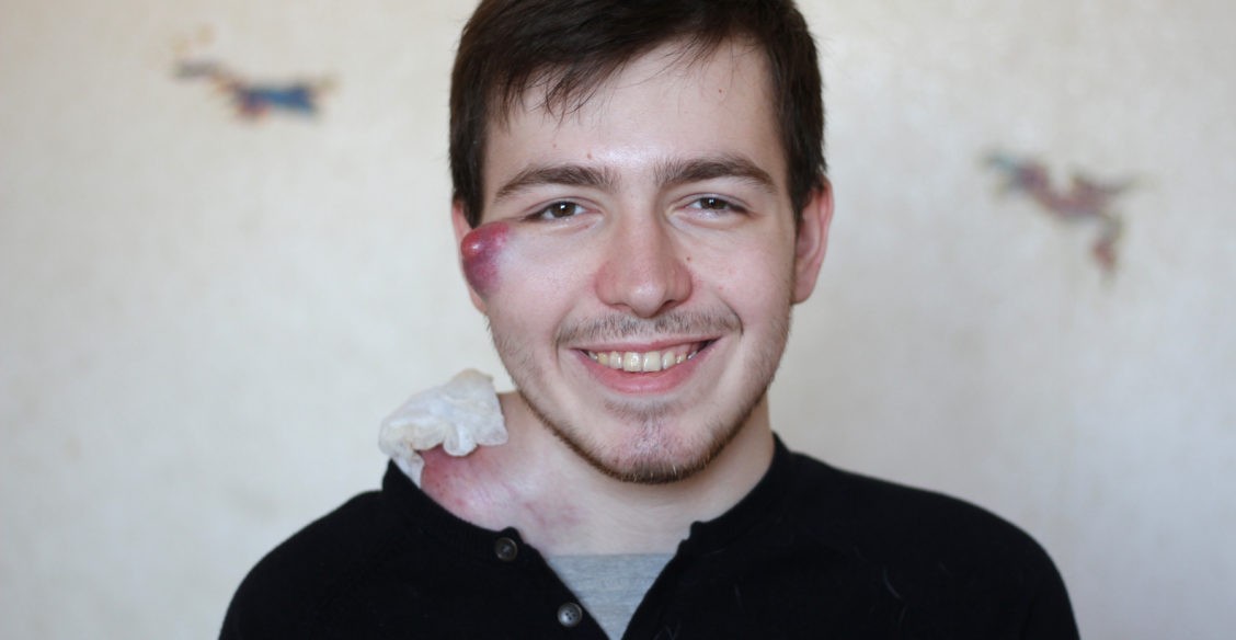 «Я стараюсь улыбаться, но это растет внутри меня»