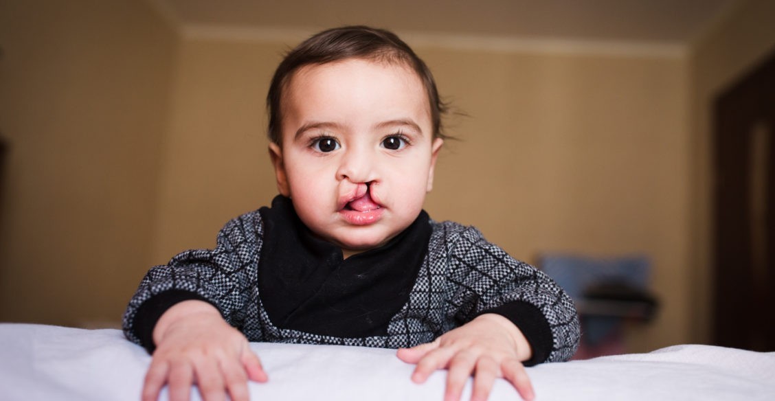 "Какой ни есть, он мой!" - крикнула мама врачам в роддоме. Сейчас пороки нужно срочно оперировать