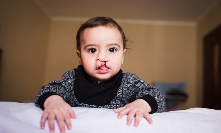 "Какой ни есть, он мой!" - крикнула мама врачам в роддоме. Сейчас пороки нужно срочно оперировать