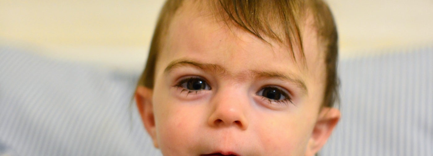 Волшебный мальчик. Как сказочная красота оказалась признаком тяжелой болезни