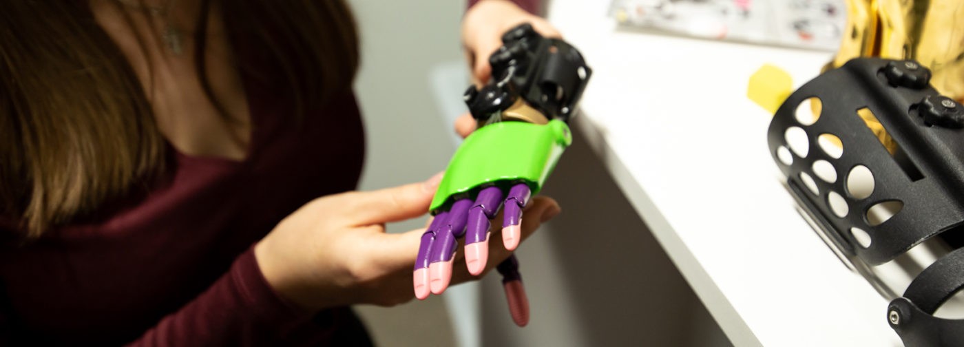 Не протезы, а руки супергероя. Как меняется мир ребенка, который получает новый орган