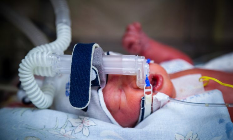 «Нужно ли было спасать?» Что будет, если отказаться от реанимации новорожденного, который не выживет