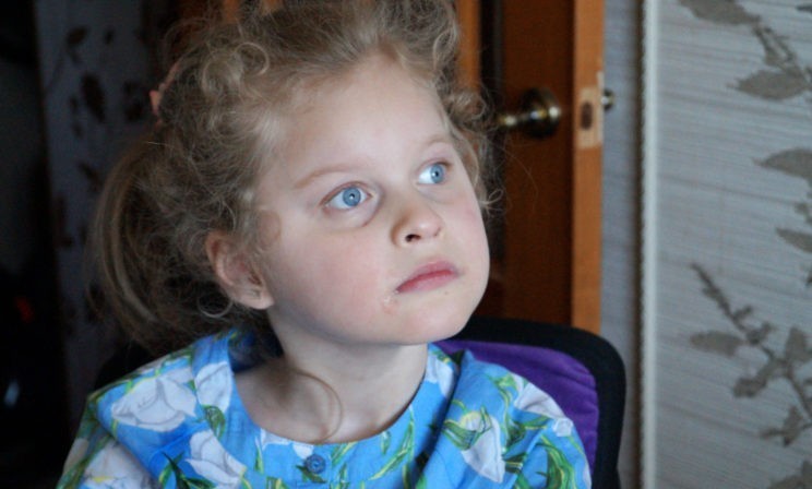 Красивая, как куколка. Но без лекарства Лера бьется в судорогах