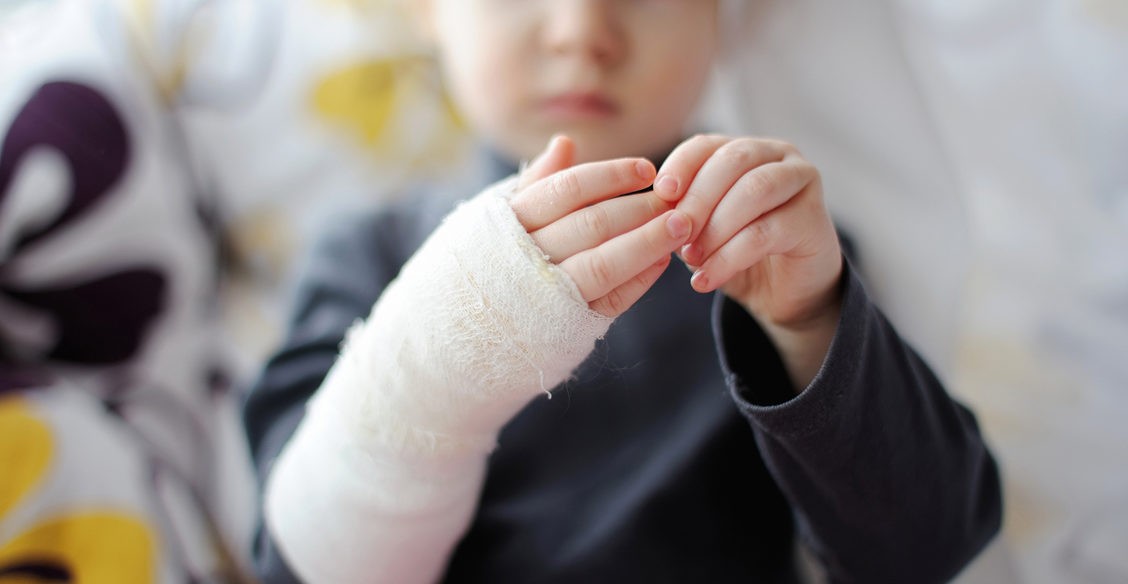 «Секунда — и ребенок падает на раскаленные угли». Врач ожогового отделения — о родительской беспечности и тяжелом лечении