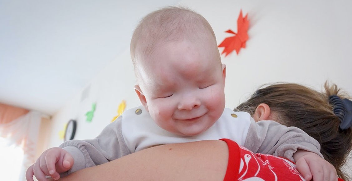 Саша родился без глаз. Но его беда совсем в другом