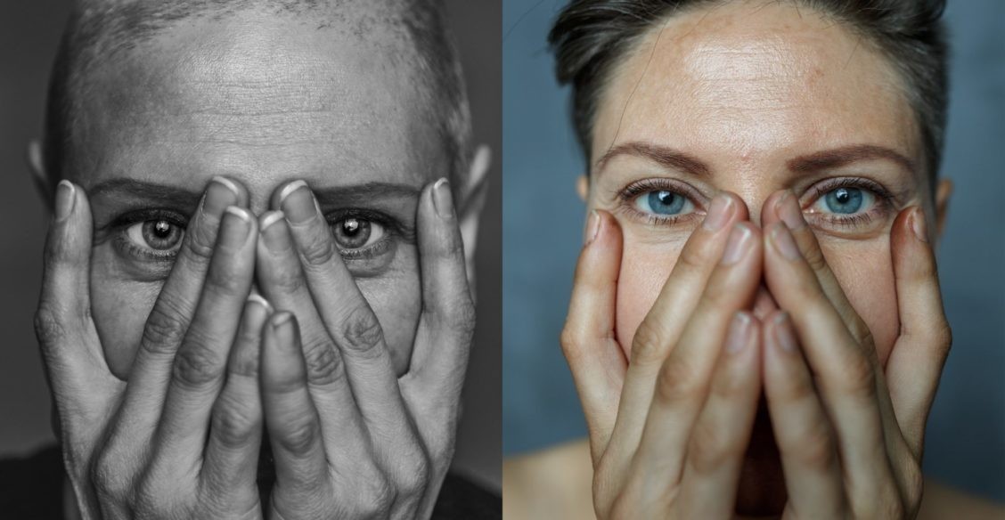 «На месте удаленной груди – птица Феникс». Как фотопроект помогает раковым больным полюбить жизнь