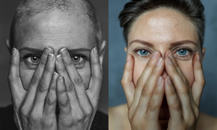 «На месте удаленной груди – птица Феникс». Как фотопроект помогает раковым больным полюбить жизнь