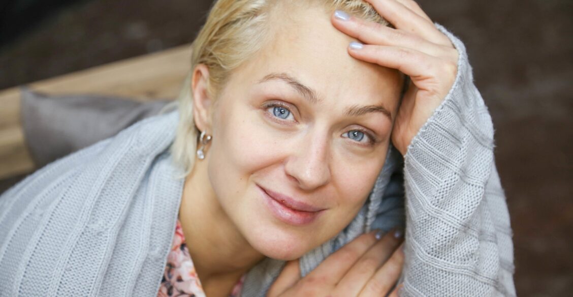 Двадцать лет я была лысой. А потом простила родителей