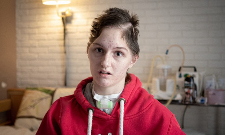 Ксюша сейчас – как котенок, которого когда-то спасла и выкормила. После ДТП у нее нет боковых костей черепа