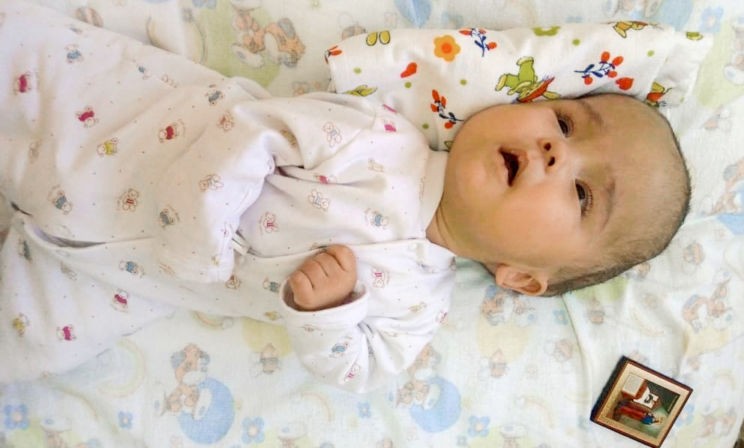 Из-за шунта у Миши выросла шишка размером с голову. А потом он ослеп и перестал глотать