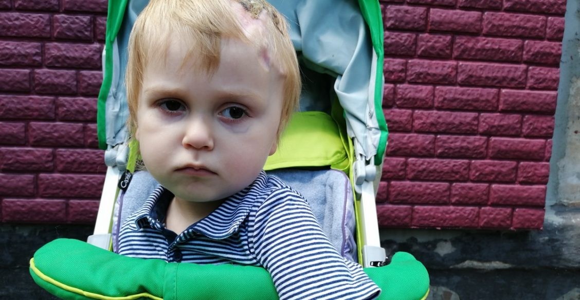 Никита пережил четыре операции на мозге. Но опухоль продолжает расти