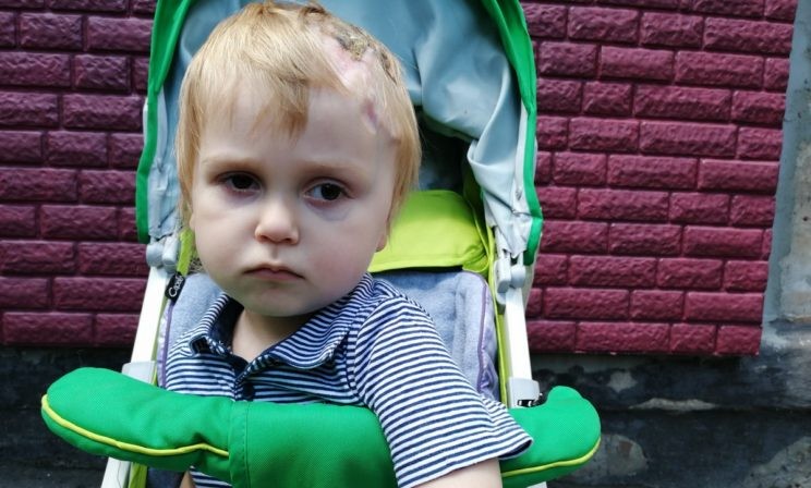 Никита пережил четыре операции на мозге. Но опухоль продолжает расти