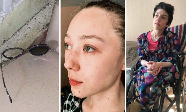 Драка за право не видеть человека в коляске. Почему мужчина разбил лицо сотруднице центра «Антон тут рядом»