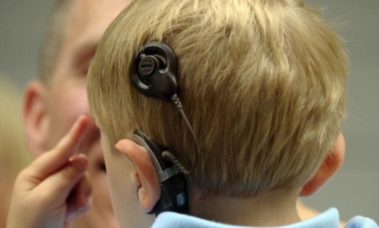 «На телевидении не было субтитров, а в школе я читала по губам». Каково быть глухим в мире слышащих