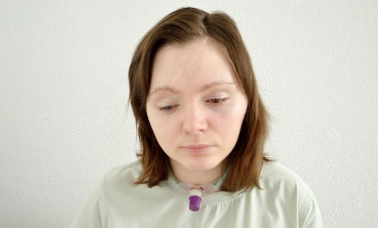 Мама повторяла: «Это не Настя! Вы что-то перепутали!» У девушки были сломаны все кости лица