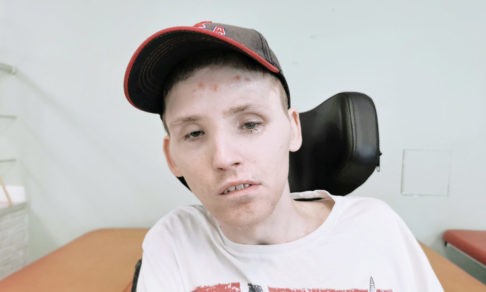 Джип подлетел и упал на машину Олега. После трепанации черепа образовалась аневризма