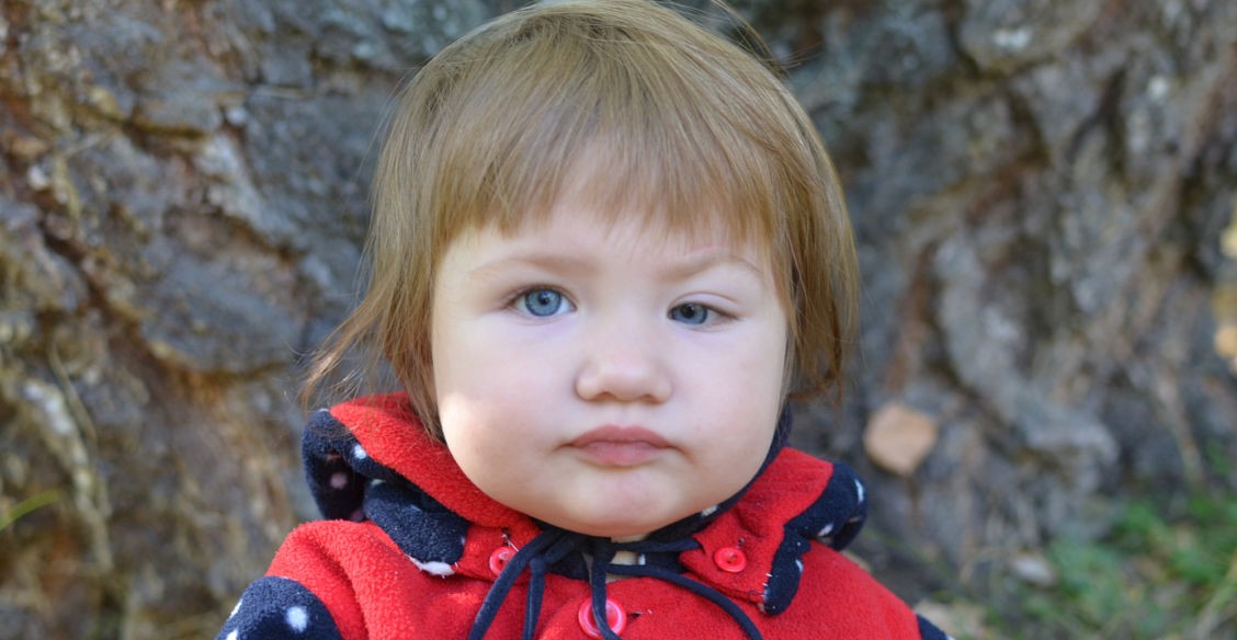 Варе нет и года, но ей уже удалили опухоль. Могут образоваться новые