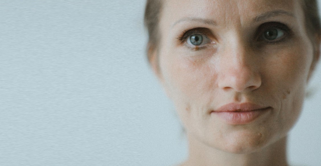 «Сын помогал мне брить голову, но свято верил, что я здорова»