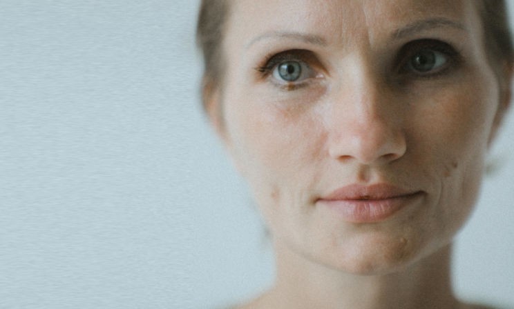 «Сын помогал мне брить голову, но свято верил, что я здорова»