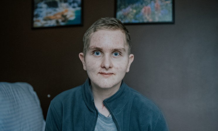 Степа мечтал стать летчиком, но попал в ДТП на скутере. Ему нужна реабилитация, чтобы снова ходить и говорить