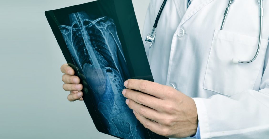 Врачей других специальностей за 4 месяца переучат на онкологов. Профессионалы говорят, что это смешно