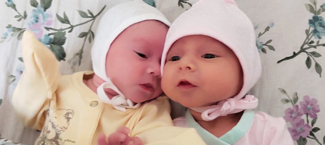 Двойняшек разлучили с рождения: одна здорова, у другой 7 операций