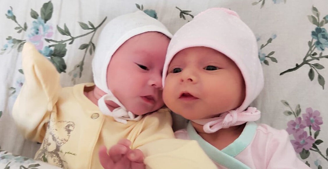 Двойняшек разлучили с рождения: одна здорова, у другой 7 операций