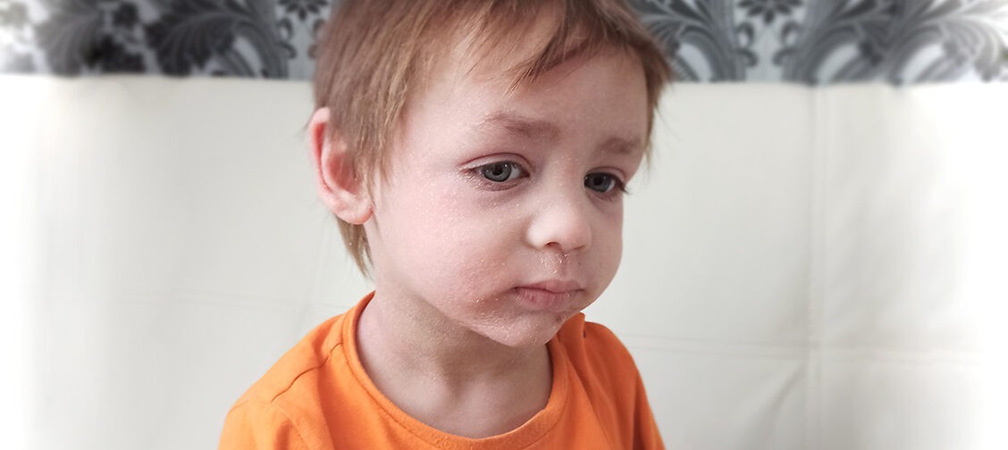 По ночам Дима расчесывает себя в кровь и кричит от боли