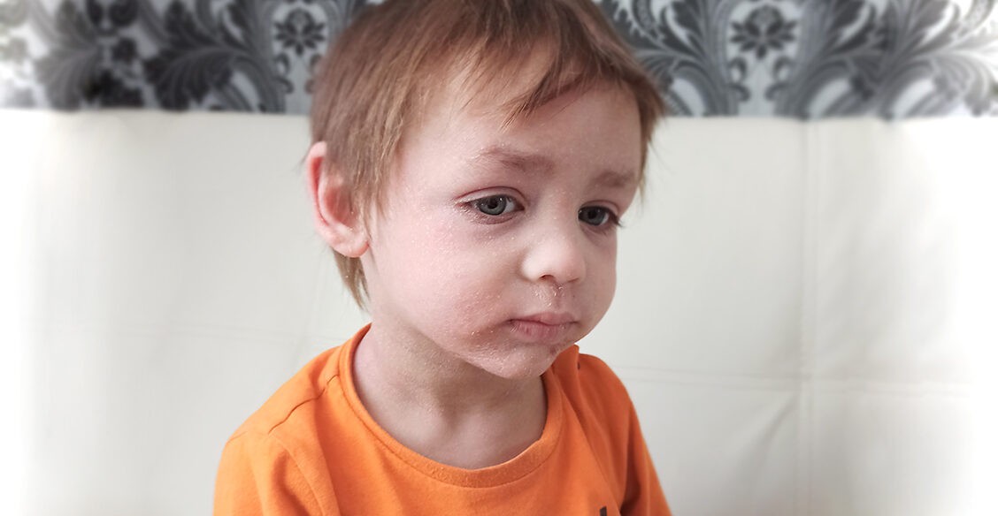 По ночам Дима расчесывает себя в кровь и кричит от боли