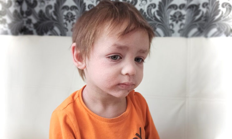 По ночам Дима расчесывает себя в кровь и кричит от боли