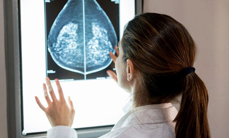 «Руки чешутся полечить». Почему скрининги опухолей приносят меньше пользы, чем хотелось бы