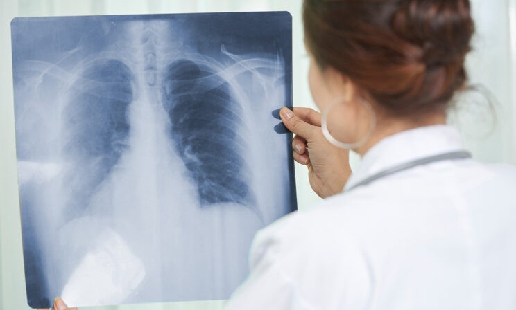 Как человек понимает, что у него туберкулез? Фтизиатр Анна Белозерова — о сложных случаях и пробе Манту