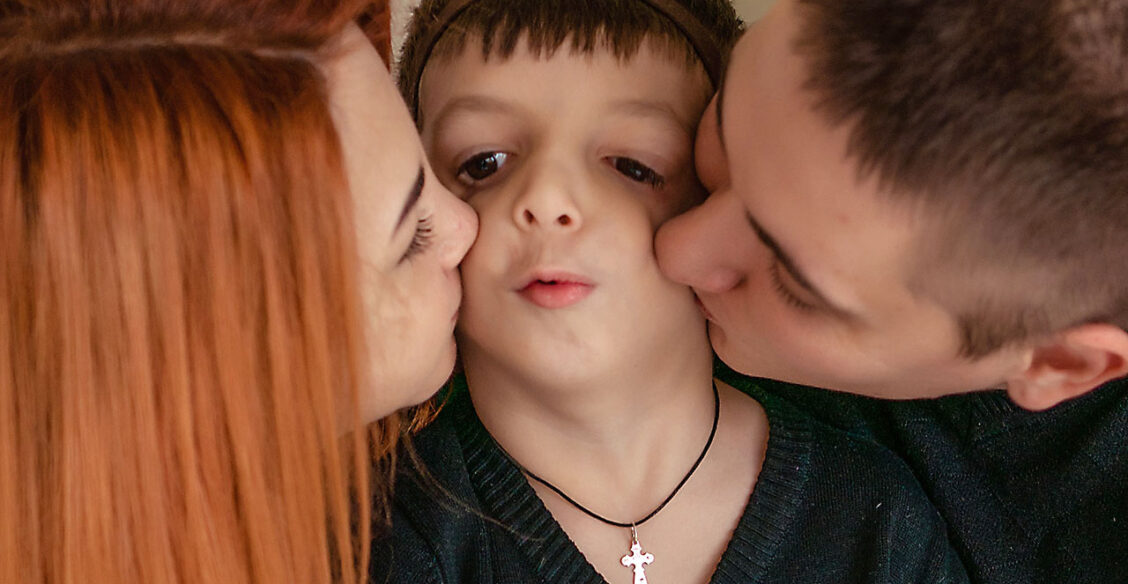 Редкий синдром Тричера Коллинза. Когда Лена родила ребенка, врачи не хотели ей его показывать