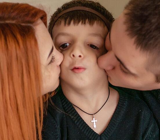 Редкий синдром Тричера Коллинза. Когда Лена родила ребенка, врачи не хотели ей его показывать
