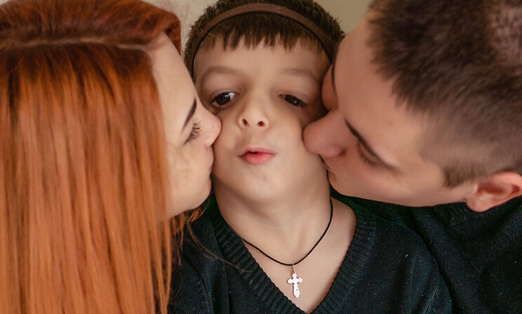 Редкий синдром Тричера Коллинза. Когда Лена родила ребенка, врачи не хотели ей его показывать