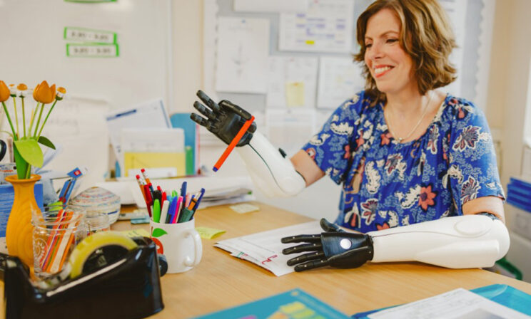 «Дети одержимы моими протезами». Учительнице ампутировали руки и ноги, но она осталась работать в школе